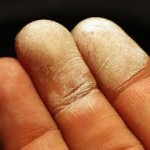35% Hydrogen Peroxide bleaches just from touching